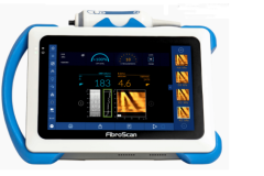 Fibroscan-Machine